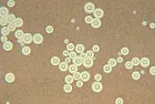 amazing |  http://en.wikipedia.org/wiki/Radiotrophic_fungusFungus that live on gamma...