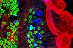 skin deep? |  Ultrasound machine had dynamic focusing since the 70's :-)What this means is...