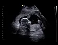 History of the sonogram and failure  |    Interesting quick read.     Mikek 