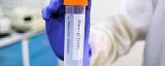 Experimental Cancer Treatment Destroys Cancer Cells Without Using Any Drugs  | next thread &raquo;