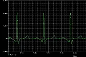 Signal generator in Microcap 12  |  ?(a): ltisim/I already have it. In fact from the same website. My problem is how...