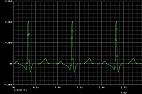 Signal generator in Microcap 12  |  ?(a): ltisim/I already have it. In fact from the same website. My problem is how...