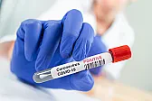 Doctors Worried (2023 Update) |  In addition to the inordinate replication rate and virulence, the Delta causes...