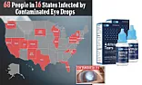 OT.   Bad Eyedrops,  Major Suppliers | &laquo; previous thread
