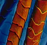 Re: A better electron microscope | next thread &raquo;