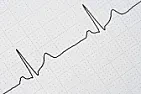 FFTs On Excel |  Has anyone heard about Fourier transforms on Excel?  Google didn'thave any...