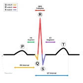 voltage regulator  |  Here's a little programmable voltage regulator to go with that 1200 volt...