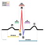 voltage regulator  |  The K2-W had about 1.5 volts of input offset and was spec'd to drift 5...